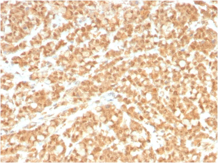Immunohistochemistry (Formalin/PFA-fixed paraffin-embedded sections) - Anti-ICOS Ligand/ICOSL antibody [ICOSL/3260] - BSA and Azide free (AB268180)