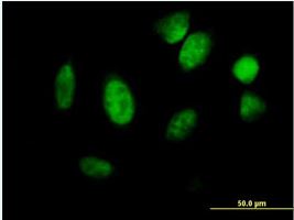 Immunocytochemistry/ Immunofluorescence - Anti-Id1 antibody (AB168256), expandable thumbnail