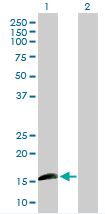 Western blot - Anti-Id1 antibody (AB168256), expandable thumbnail
