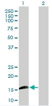 Western blot - Anti-Id1 antibody (AB168256)