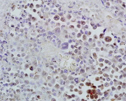Immunohistochemistry (Formalin/PFA-fixed paraffin-embedded sections) - Anti-Id1 antibody (AB203202)