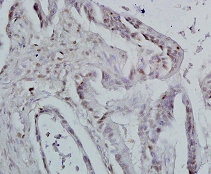 Immunohistochemistry (Formalin/PFA-fixed paraffin-embedded sections) - Anti-Id1 antibody (AB203202), expandable thumbnail