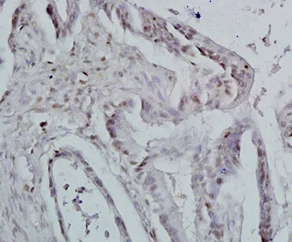 Immunohistochemistry (Formalin/PFA-fixed paraffin-embedded sections) - Anti-Id1 antibody (AB203202)