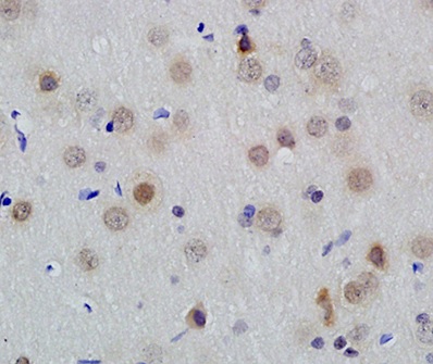 Immunohistochemistry (Formalin/PFA-fixed paraffin-embedded sections) - Anti-Id1 antibody (AB203202), expandable thumbnail