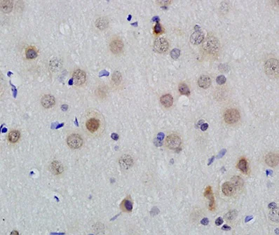 Immunohistochemistry (Formalin/PFA-fixed paraffin-embedded sections) - Anti-Id1 antibody (AB203202)