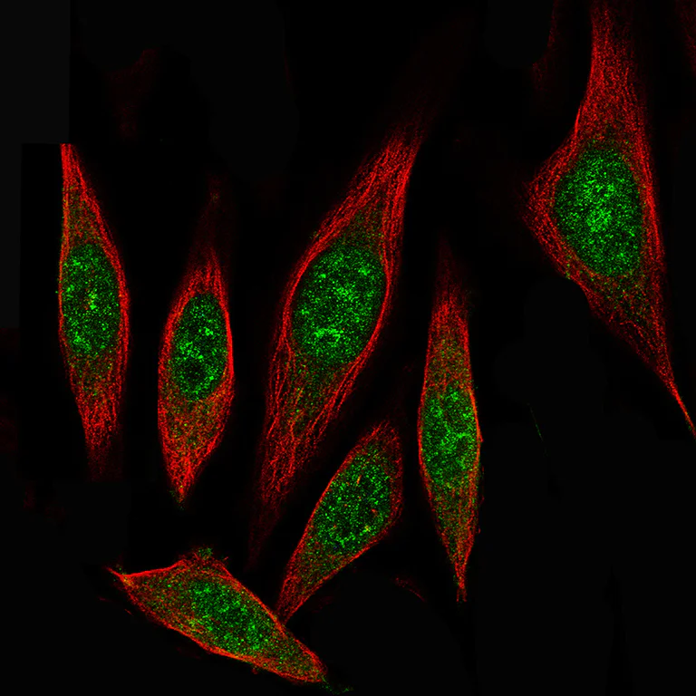 Immunocytochemistry/ Immunofluorescence - Anti-ID1 Antibody [CL11981] (AB327136)