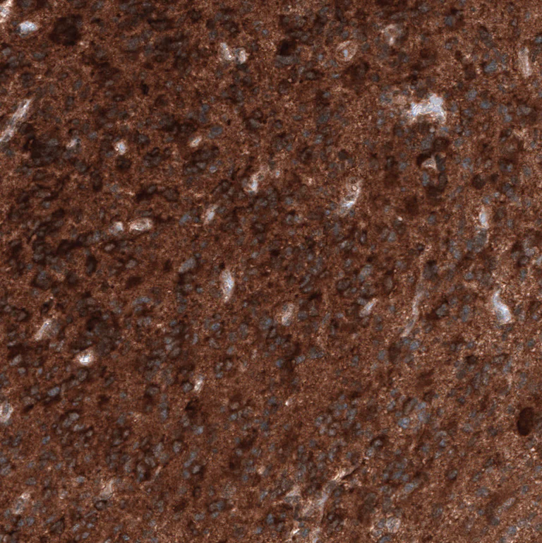 Immunohistochemistry (Formalin/PFA-fixed paraffin-embedded sections) - Anti-ID1 Antibody [CL11981] (AB327136)