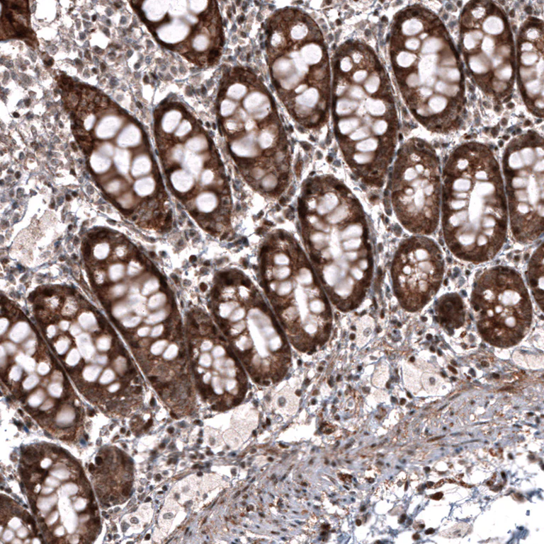Immunohistochemistry (Formalin/PFA-fixed paraffin-embedded sections) - Anti-ID1 Antibody [CL11981] (AB327136)