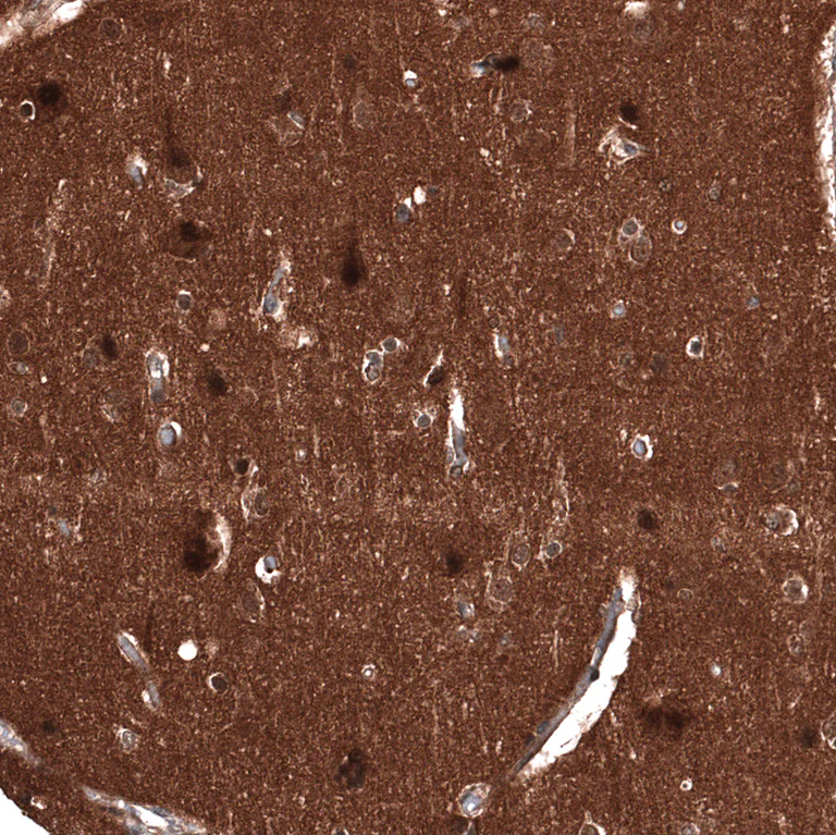Immunohistochemistry (Formalin/PFA-fixed paraffin-embedded sections) - Anti-ID1 Antibody [CL11981] (AB327136)
