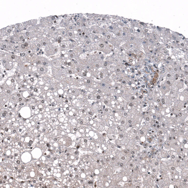 Immunohistochemistry (Formalin/PFA-fixed paraffin-embedded sections) - Anti-ID1 Antibody [CL11981] (AB327136)
