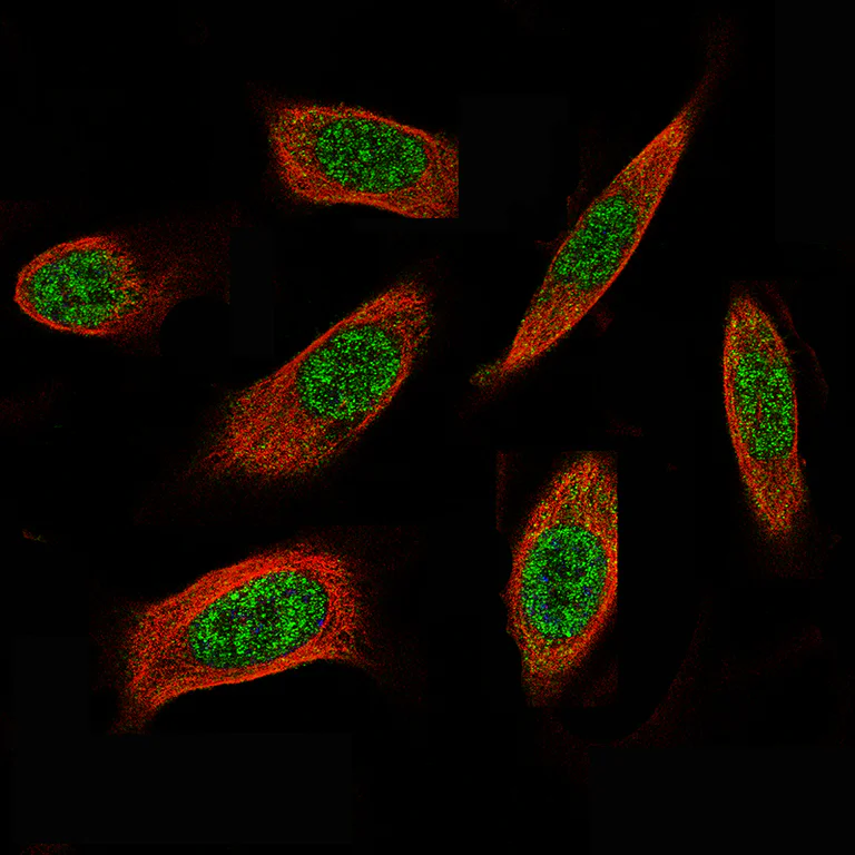 Immunocytochemistry/ Immunofluorescence - Anti-ID1 Antibody [CL11995] (AB327137)