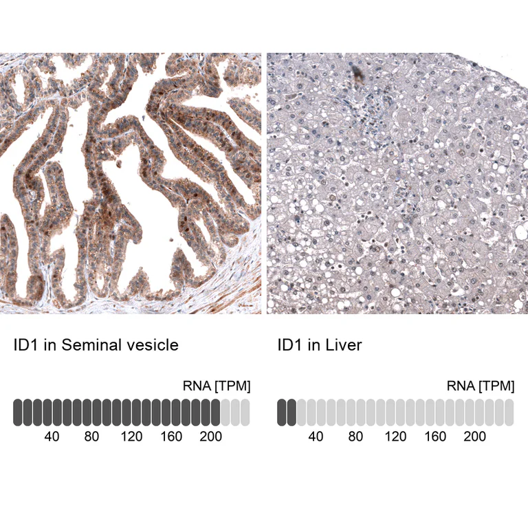 Immunohistochemistry (Formalin/PFA-fixed paraffin-embedded sections) - Anti-ID1 Antibody [CL11995] (AB327137)
