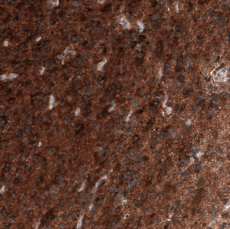 Immunohistochemistry (Formalin/PFA-fixed paraffin-embedded sections) - Anti-ID1 Antibody [CL11995] (AB327137)