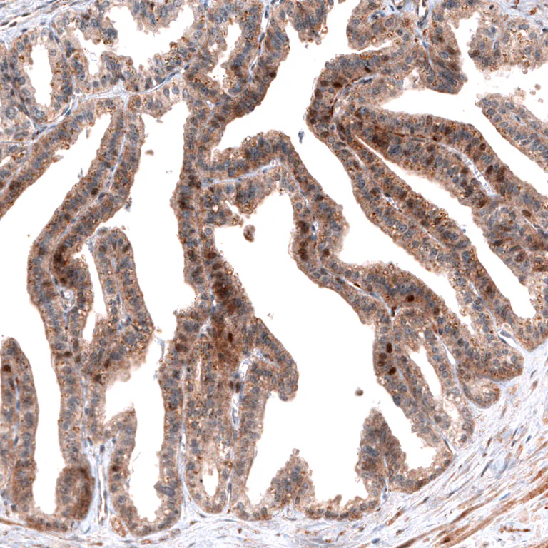Immunohistochemistry (Formalin/PFA-fixed paraffin-embedded sections) - Anti-ID1 Antibody [CL11995] (AB327137)