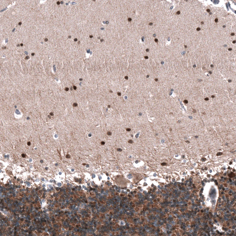 Immunohistochemistry (Formalin/PFA-fixed paraffin-embedded sections) - Anti-ID1 Antibody [CL11995] (AB327137)
