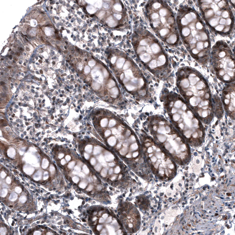 Immunohistochemistry (Formalin/PFA-fixed paraffin-embedded sections) - Anti-ID1 Antibody [CL11995] (AB327137)