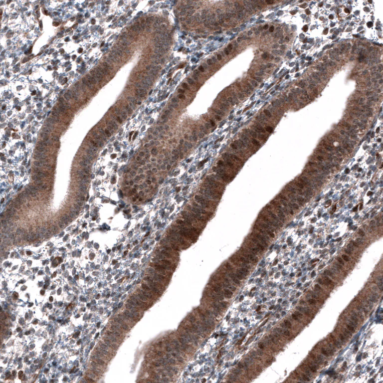 Immunohistochemistry (Formalin/PFA-fixed paraffin-embedded sections) - Anti-ID1 Antibody [CL11995] (AB327137)