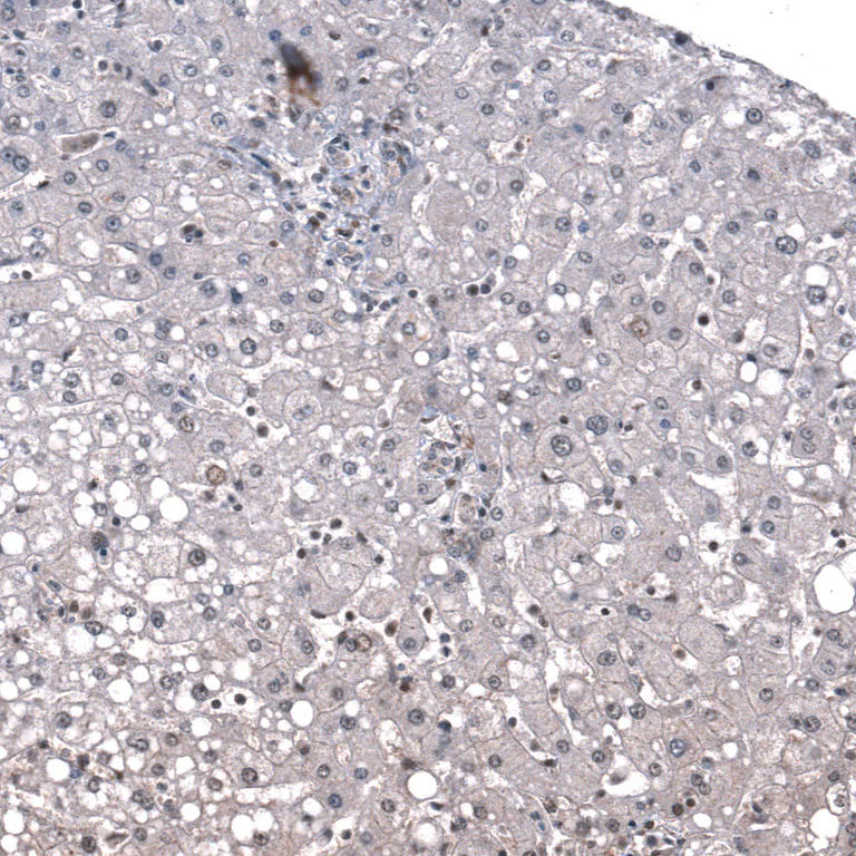 Immunohistochemistry (Formalin/PFA-fixed paraffin-embedded sections) - Anti-ID1 Antibody [CL11995] (AB327137)