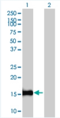 Western blot - ID2 overexpression 293T lysate (whole cell) (AB94214), expandable thumbnail