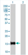 Western blot - ID2 overexpression 293T lysate (whole cell) (AB94214)