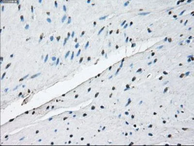 Immunohistochemistry (Formalin/PFA-fixed paraffin-embedded sections) - Anti-ID3 antibody [OTI8B3] (AB236505)