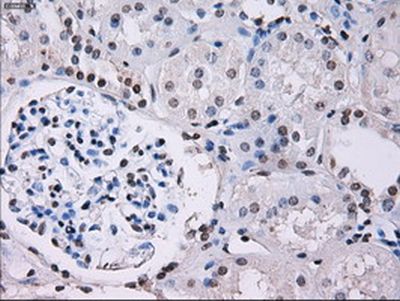 Immunohistochemistry (Formalin/PFA-fixed paraffin-embedded sections) - Anti-ID3 antibody [OTI8B3] (AB236505)
