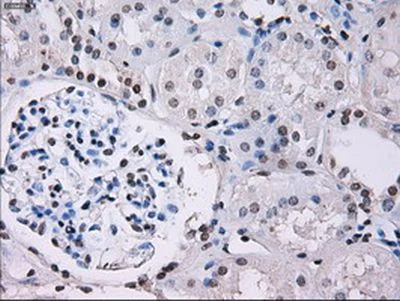 Immunohistochemistry (Formalin/PFA-fixed paraffin-embedded sections) - Anti-ID3 antibody [OTI8B3] (AB236505)