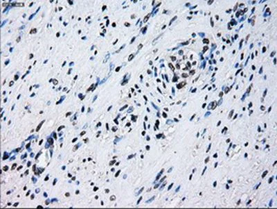 Immunohistochemistry (Formalin/PFA-fixed paraffin-embedded sections) - Anti-ID3 antibody [OTI8B3] (AB236505)