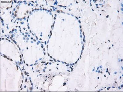 Immunohistochemistry (Formalin/PFA-fixed paraffin-embedded sections) - Anti-ID3 antibody [OTI8B3] (AB236505)