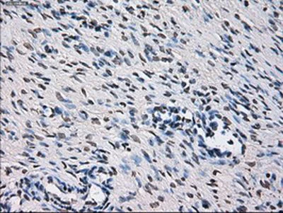 Immunohistochemistry (Formalin/PFA-fixed paraffin-embedded sections) - Anti-ID3 antibody [OTI8B3] (AB236505)