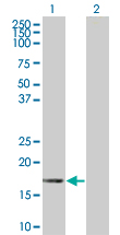 Western blot - ID3 overexpression 293T lysate (whole cell) (AB94230), expandable thumbnail