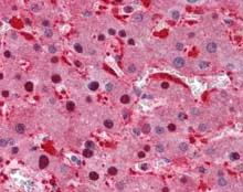 Immunohistochemistry (Formalin/PFA-fixed paraffin-embedded sections) - Anti-IDH1 antibody (AB113232)