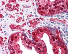 Immunohistochemistry (Formalin/PFA-fixed paraffin-embedded sections) - Anti-IDH1 antibody (AB113232)