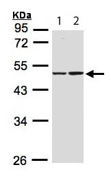 Western blot - Anti-IDH1 antibody (AB113232), expandable thumbnail