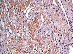 Immunohistochemistry (Formalin/PFA-fixed paraffin-embedded sections) - Anti-IDH1 antibody (AB137568)