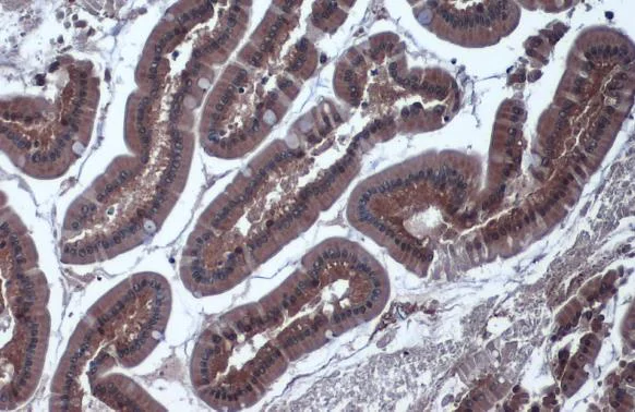 Immunohistochemistry (Formalin/PFA-fixed paraffin-embedded sections) - Anti-IDH1 antibody (AB137568)