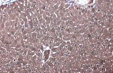 Immunohistochemistry (Formalin/PFA-fixed paraffin-embedded sections) - Anti-IDH1 antibody (AB137568)