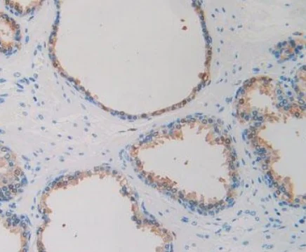 Immunohistochemistry (Formalin/PFA-fixed paraffin-embedded sections) - Anti-IDH1 antibody [C12] (AB239606)