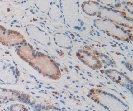 Immunohistochemistry (Formalin/PFA-fixed paraffin-embedded sections) - Anti-IDH1 antibody [C12] (AB239606)