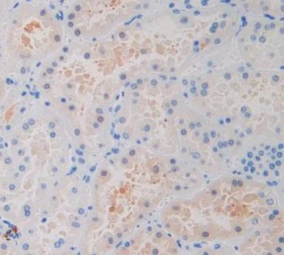 Immunohistochemistry (Formalin/PFA-fixed paraffin-embedded sections) - Anti-IDH1 antibody [C12] (AB239606)