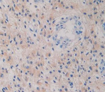 Immunohistochemistry (Formalin/PFA-fixed paraffin-embedded sections) - Anti-IDH1 antibody [C12] (AB239606)