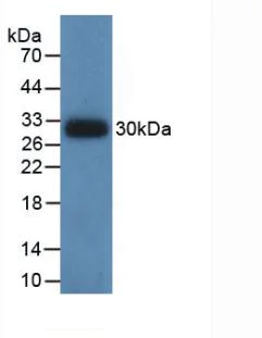 Western blot - Anti-IDH1 antibody [C12] (AB239606)