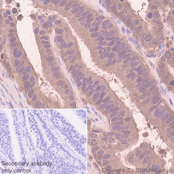 Immunohistochemistry (Formalin/PFA-fixed paraffin-embedded sections) - Anti-IDH1 antibody [EPR12296] - BSA and Azide free (AB214803)