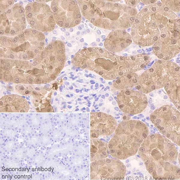 Immunohistochemistry (Formalin/PFA-fixed paraffin-embedded sections) - Anti-IDH1 antibody [EPR21002] - BSA and Azide free (AB242078)