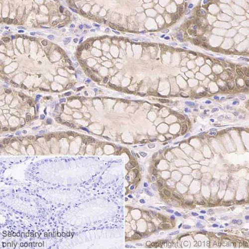 Immunohistochemistry (Formalin/PFA-fixed paraffin-embedded sections) - Anti-IDH1 antibody [EPR21002] - BSA and Azide free (AB242078)
