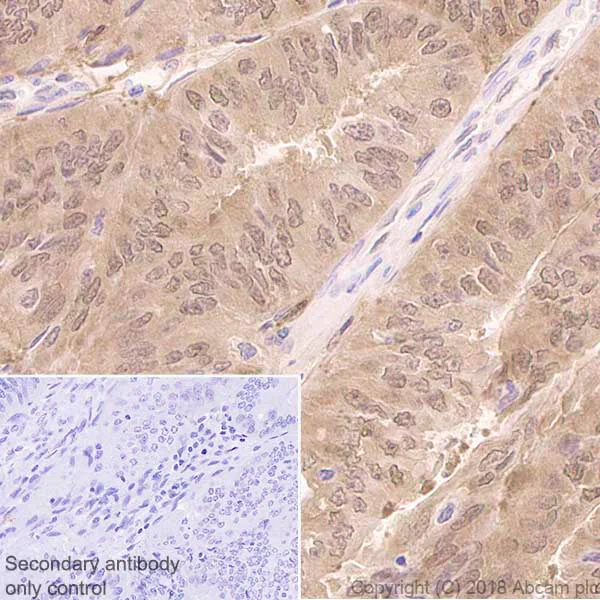 Immunohistochemistry (Formalin/PFA-fixed paraffin-embedded sections) - Anti-IDH1 antibody [EPR21002] - BSA and Azide free (AB242078)