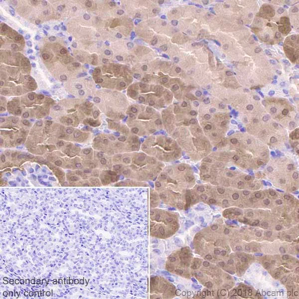 Immunohistochemistry (Formalin/PFA-fixed paraffin-embedded sections) - Anti-IDH1 antibody [EPR21002] - BSA and Azide free (AB242078)