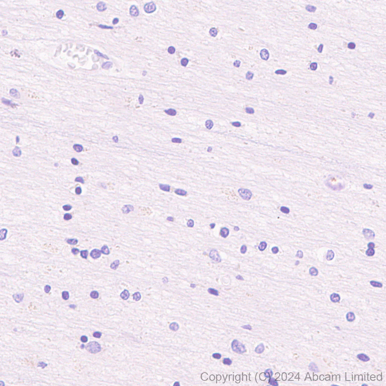 Immunohistochemistry (Formalin/PFA-fixed paraffin-embedded sections) - Anti-IDH1 antibody [EPR26774-1] - BSA and Azide free (AB325964)
