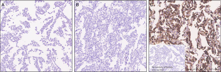 Immunohistochemistry (Formalin/PFA-fixed paraffin-embedded sections) - Anti-IDH1 antibody [EPR26774-1] - BSA and Azide free (AB325964)