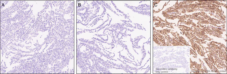 Immunohistochemistry (Formalin/PFA-fixed paraffin-embedded sections) - Anti-IDH1 antibody [EPR26774-1] - BSA and Azide free (AB325964)